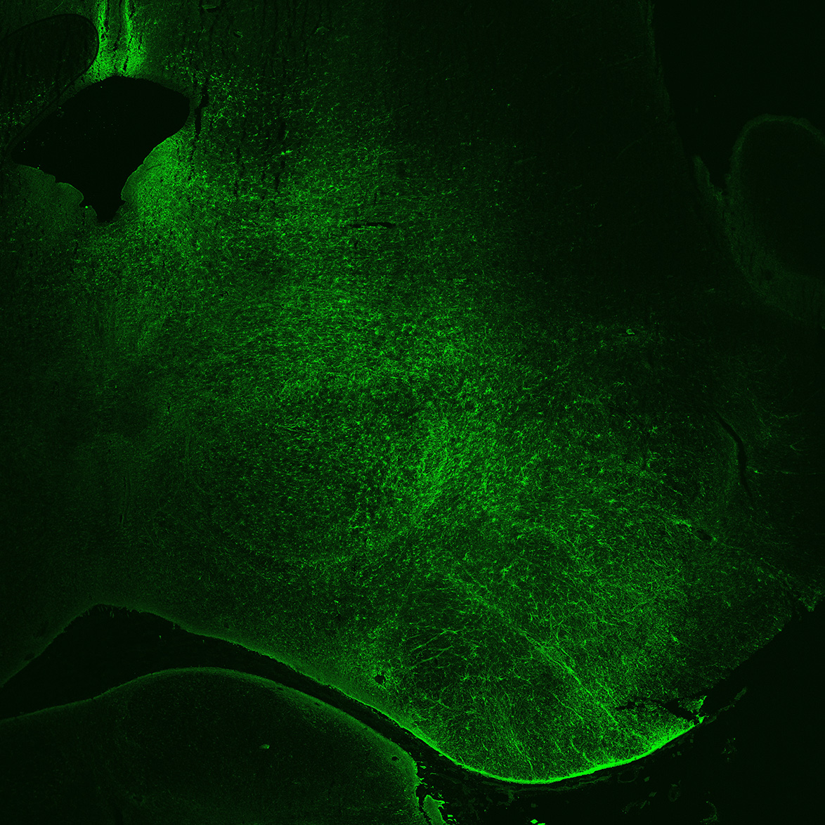 Human foetal midbrain